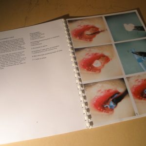 Temporal Bone Dissection Manual