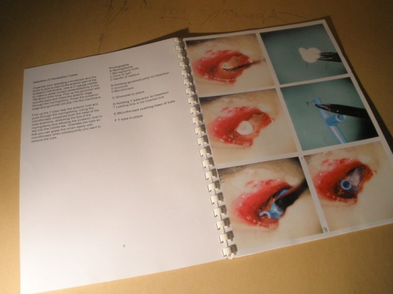 Temporal Bone Dissection Manual